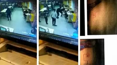 हैदराबाद में फास्ट फूड कंपनी के आउटलेट में 8 साल के बच्चे को चूहे ने काटा