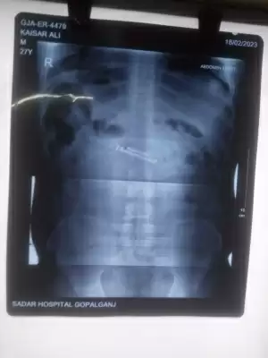 पकड़े जाने के डर से कैदी ने निगला मोबाइल, पुलिस अब इलाज करवाने में जुटी