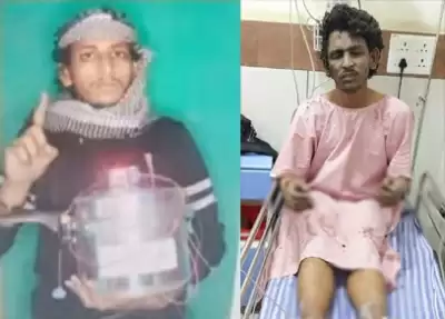 मंगलुरु कुकर ब्लास्ट मामला : संदिग्ध आतंकी को अस्पताल से मिली छुट्टी