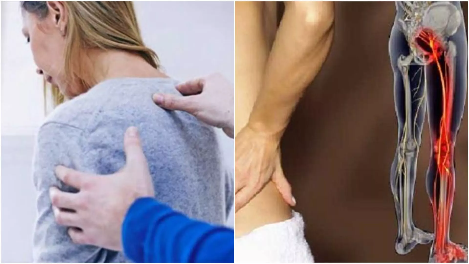 जानिए क्या है साइटिका और कैसे करें इसका घरेलू इलाज