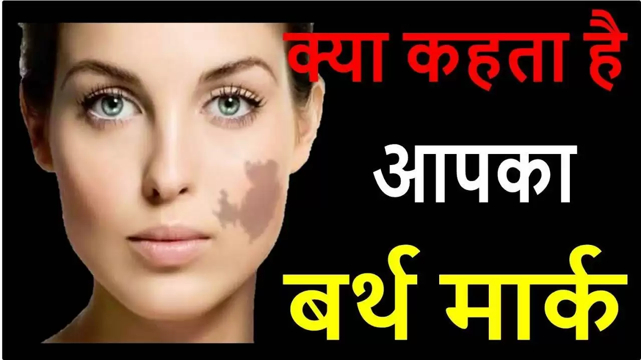 जानें आपका Birthmark आपके बारे में क्या कहता है