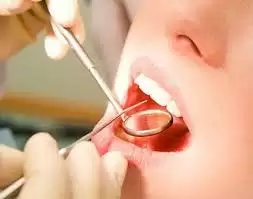 दातों का हिलना रोके दातों को मजबूत बनायें ये असरदार उपाए