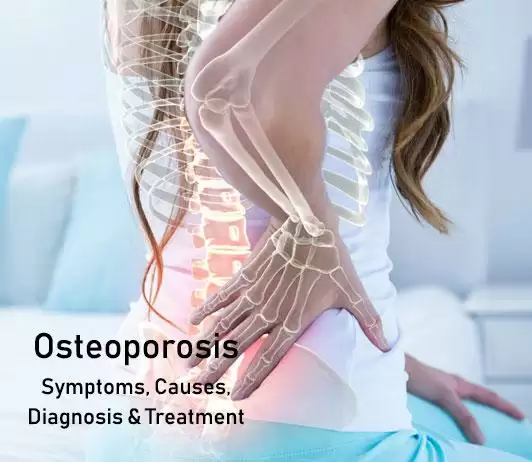 50 की उम्र के बाद बढ़ जाता है osteoporosis का ख़तरा, इस तरह से हो सकता है बचाव