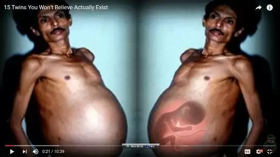 Video- कभी देखा है गर्भवती आदमी, जानिये कैसे हो गया ये प्रेग्नेंट