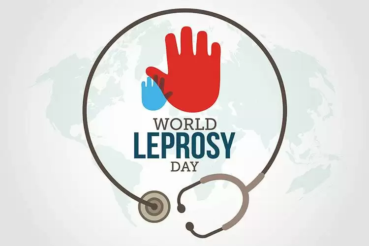 ग्लोबल लेप्रोसी डे-क्ुष्ठ रोग का इलाज संभव है समाज में भेदभाव की जगह नहीं है