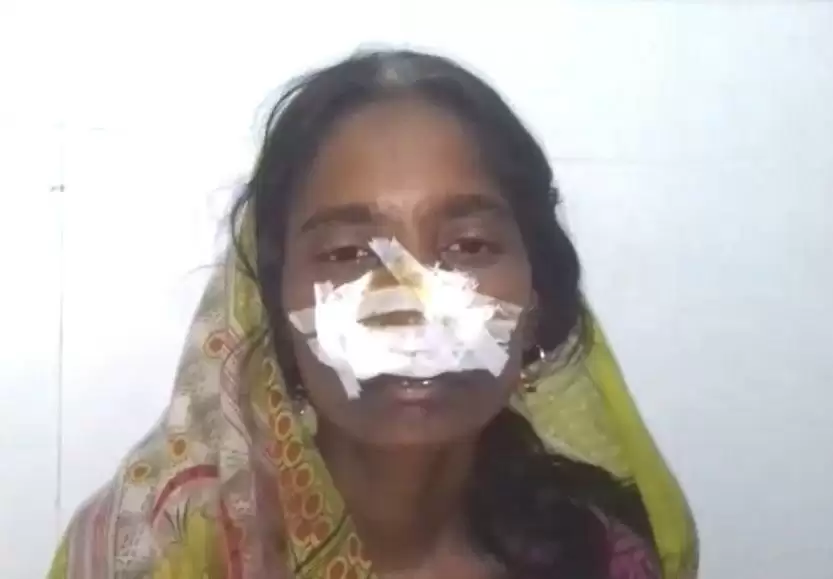 पति ने अपनी पत्नी की नाक काट दी