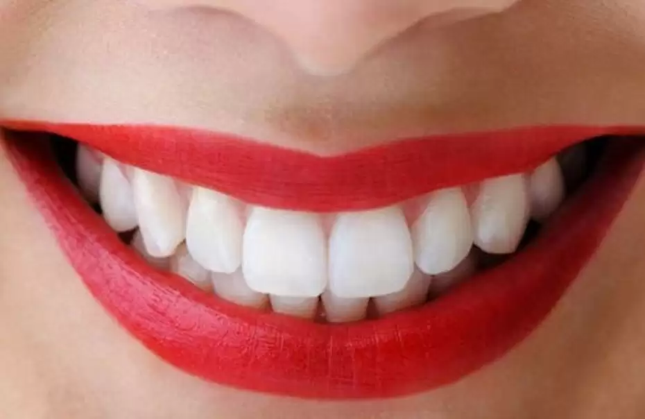 आपके पीले दांत भी होंगे ,सफेद अपनाये ये 5 टिप्स