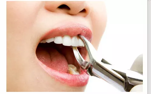Sensitive teeth treatment at home: अपनाएं ये तरीके, 100 साल चमकेंगे दांत