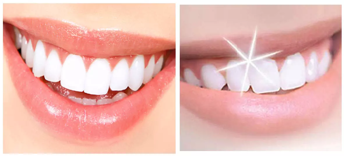 बुढ़ापे में न हो आपके दांत ख़राब तो करे ये उपाय जानिए क्या