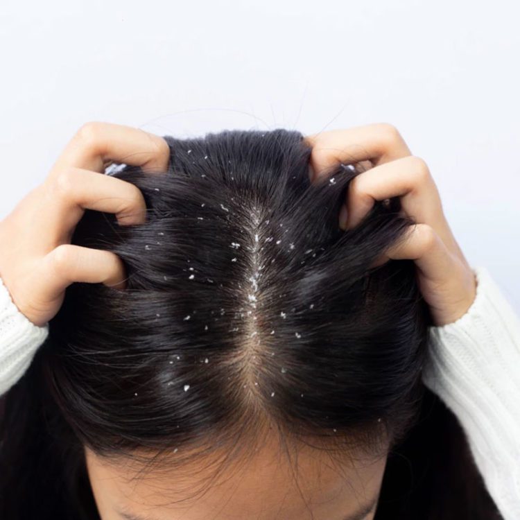 Heater disadvantages for skin and hair in hindi