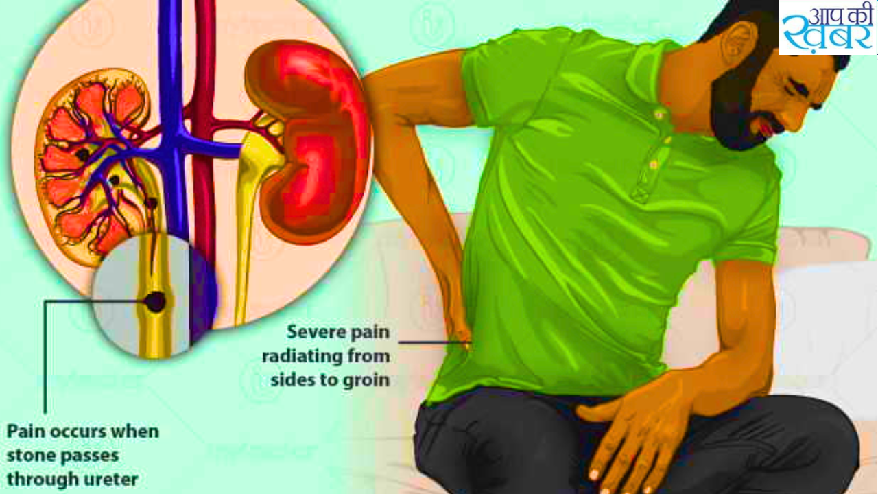 Which Ayurvedic medicine is best for kidney stones? किडनी स्टोन के लिए कौन सी आयुर्वेदिक दवा सबसे अच्छी है?