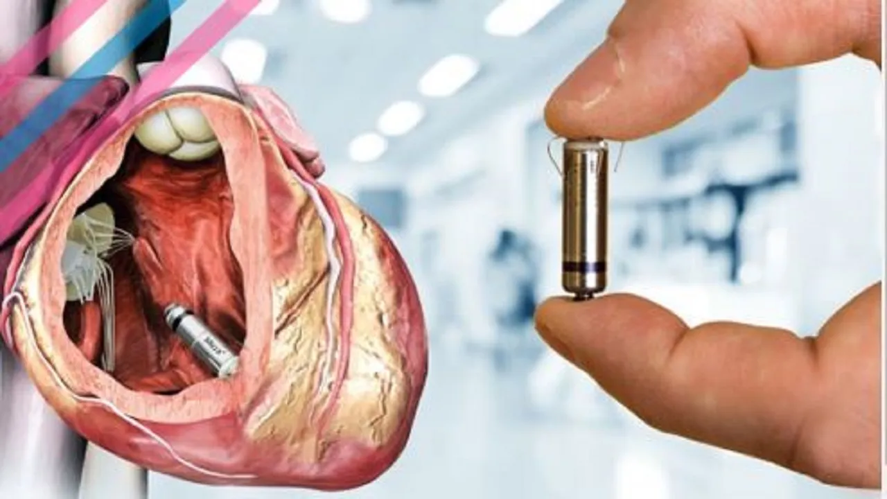 Next generation leadless pacemakers: A new revolution in treating abnormal heart rhythms