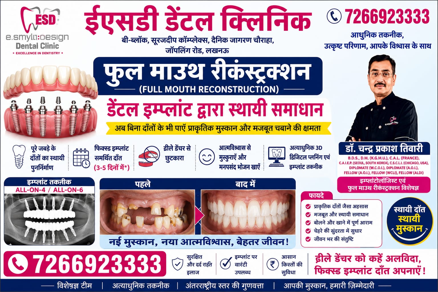 Full Mouth Reconstruction: गंदे और खराब दांतों से खो गई है मुस्कान? लखनऊ के ESD क्लिनिक में 'फुल माउथ रीकंस्ट्रक्शन' से पाएं स्थायी समाधान