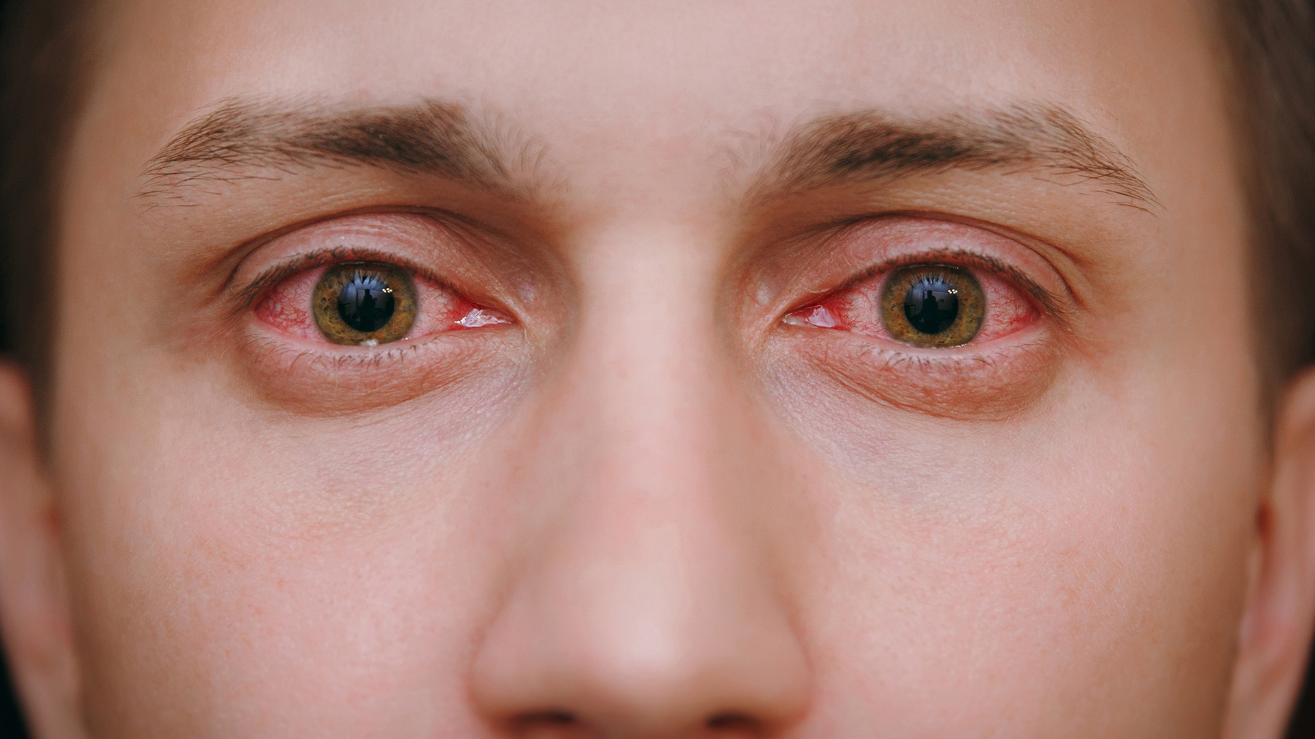 क्या हीटर आंखों को नुकसान पहुंचा सकता है?