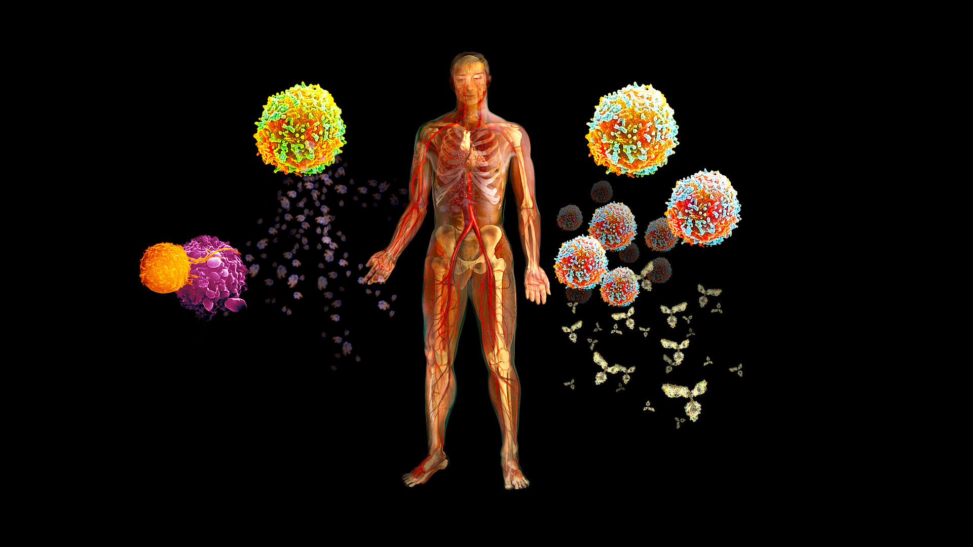 What is immune system disease and infection